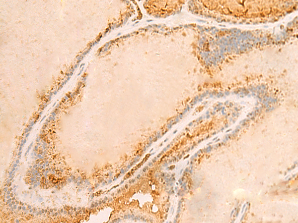 Rabbit Polyclonal Antibody to RAB1A