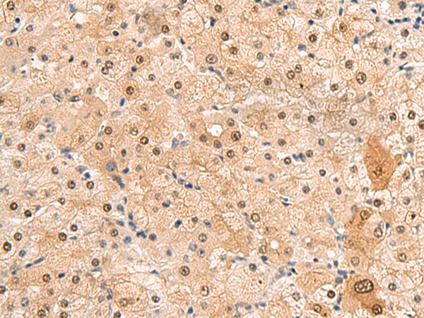 Rabbit Polyclonal Antibody to HEBP2