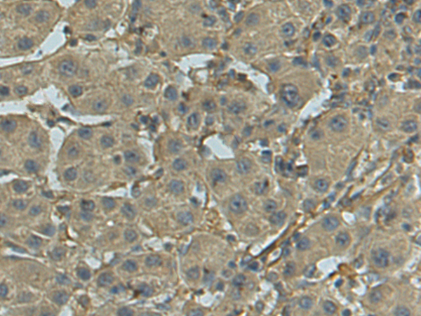 Rabbit Polyclonal Antibody to TCEANC2