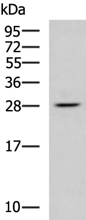 Rabbit Polyclonal Antibody to RPL13