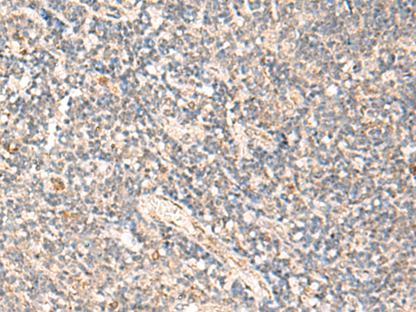 Rabbit Polyclonal Antibody to MOB1A