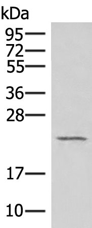 Rabbit Polyclonal Antibody to POP4