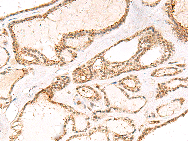 Rabbit Polyclonal Antibody to DCAF10