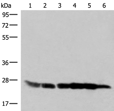 Rabbit Polyclonal Antibody to GSTK1