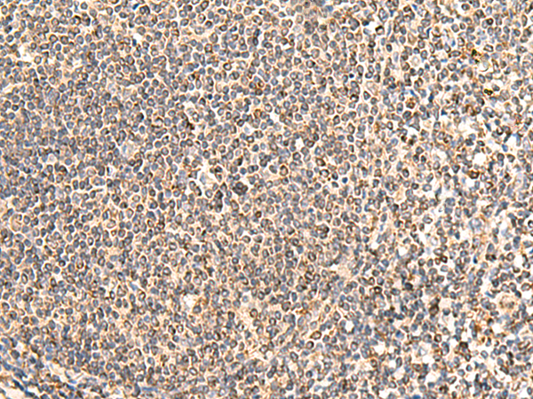 Rabbit Polyclonal Antibody to NEGR1