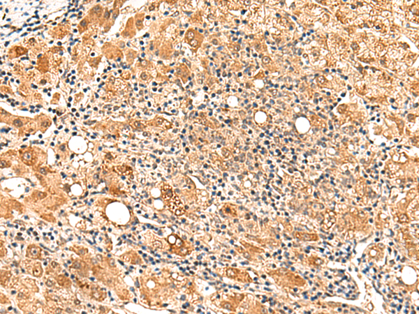 Rabbit Polyclonal Antibody to PAFAH1B2