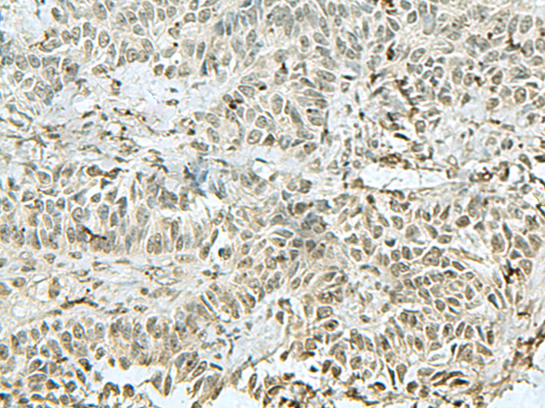 Rabbit Polyclonal Antibody to THTPA