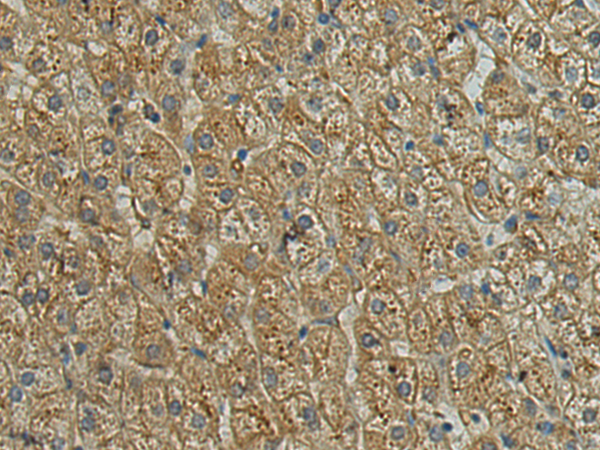 Rabbit Polyclonal Antibody to SCNM1