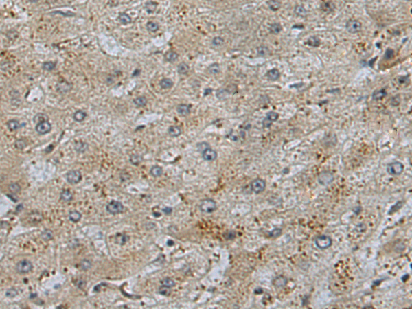 Rabbit Polyclonal Antibody to MAMDC2