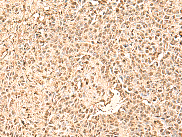 Rabbit Polyclonal Antibody to SMNDC1