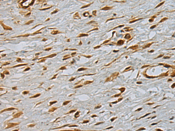 Rabbit Polyclonal Antibody to MACROD1