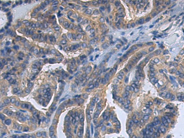 Rabbit Polyclonal Antibody to ATP6V1D