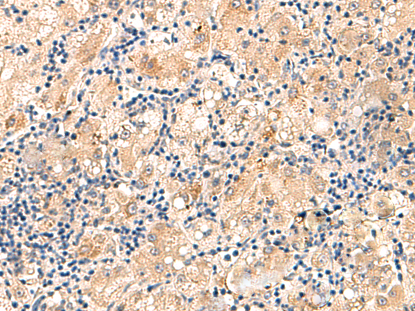 Rabbit Polyclonal Antibody to MRPL16