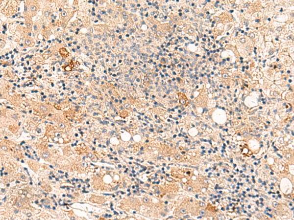 Rabbit Polyclonal Antibody to SULT4A1
