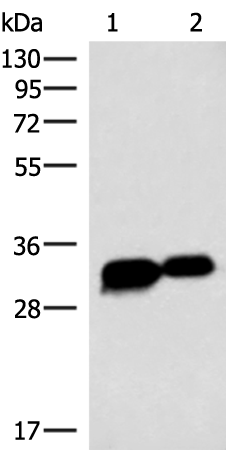 Rabbit Polyclonal Antibody to HCCS