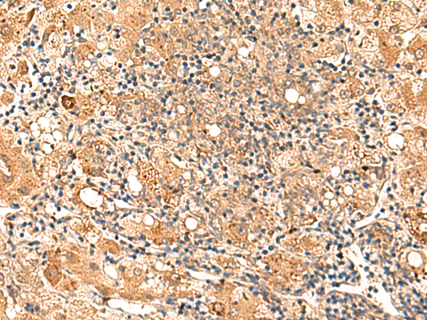 Rabbit Polyclonal Antibody to GALNT12