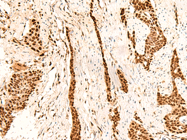 Rabbit Polyclonal Antibody to METTL1