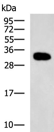 Rabbit Polyclonal Antibody to ZNF688