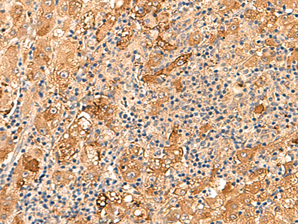Rabbit Polyclonal Antibody to KCNE3