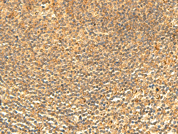 Rabbit Polyclonal Antibody to ABHD10