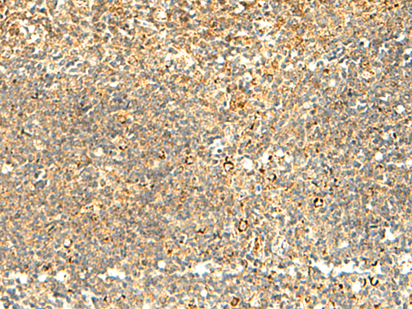 Rabbit Polyclonal Antibody to NAPRT