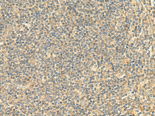 Rabbit Polyclonal Antibody to NTAN1