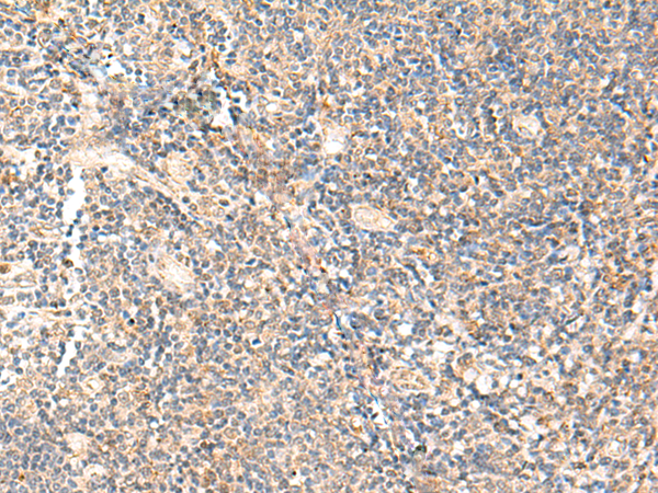 Rabbit Polyclonal Antibody to PPP1R3C