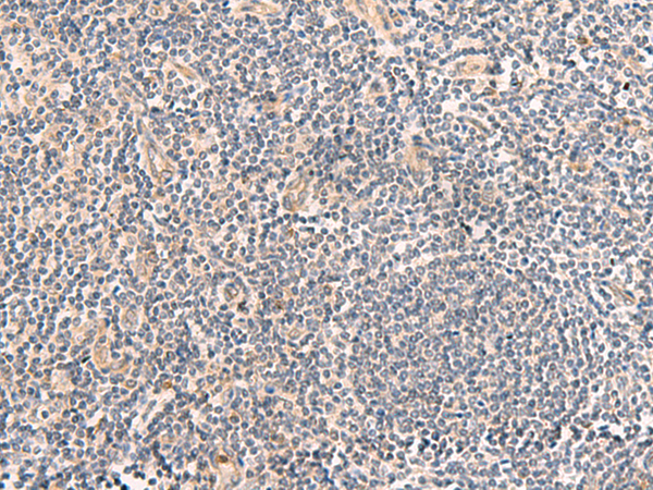 Rabbit Polyclonal Antibody to TEAD3