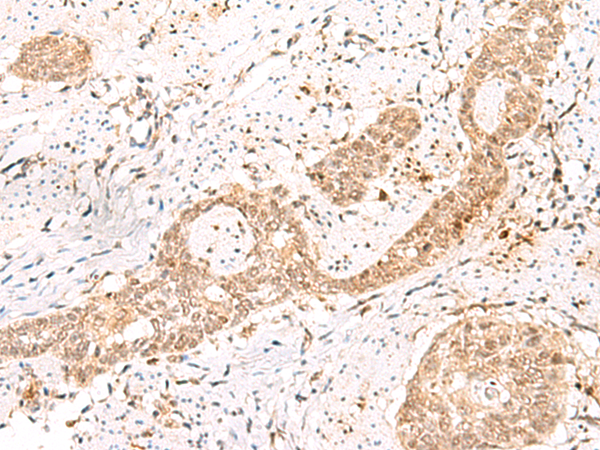 Rabbit Polyclonal Antibody to PRKAG2