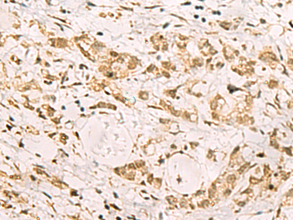 Rabbit Polyclonal Antibody to PDS5A