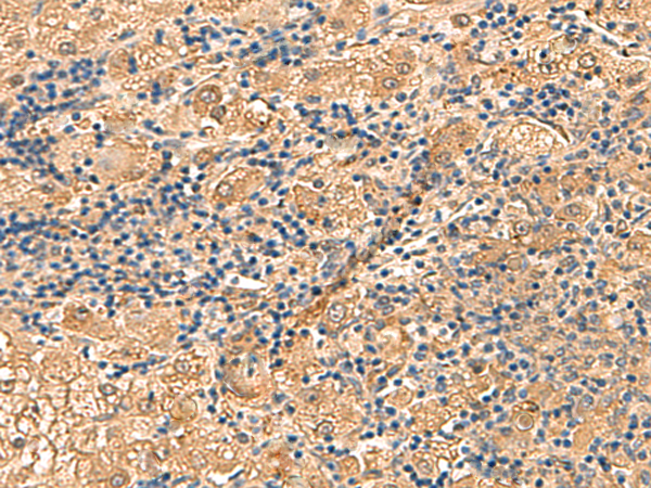 Rabbit Polyclonal Antibody to PTH1R