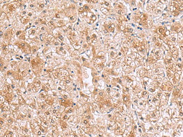 Rabbit Polyclonal Antibody to RTKN2