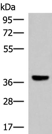 Rabbit Polyclonal Antibody to LRG1