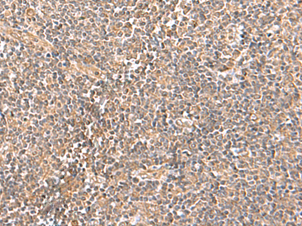Rabbit Polyclonal Antibody to TRUB1
