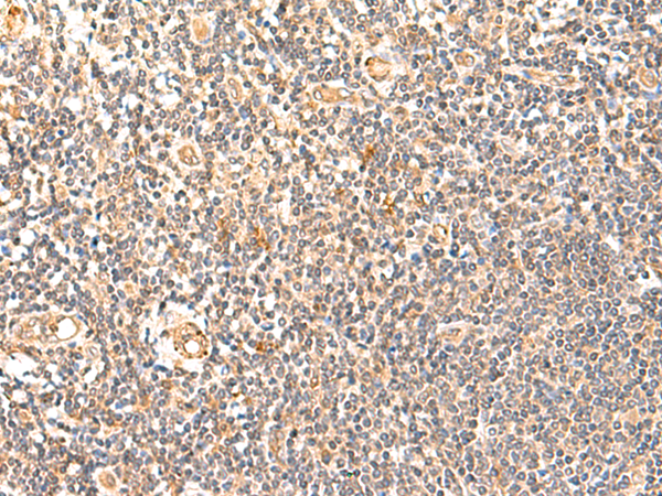 Rabbit Polyclonal Antibody to GPD1L