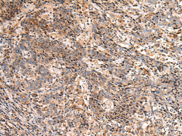 Rabbit Polyclonal Antibody to EIF2B2