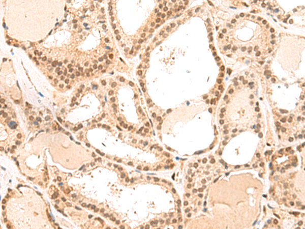 Rabbit Polyclonal Antibody to MKX