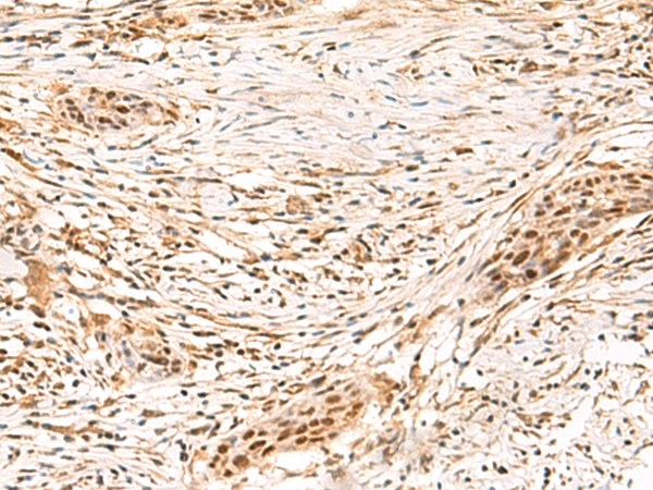Rabbit Polyclonal Antibody to SETMAR