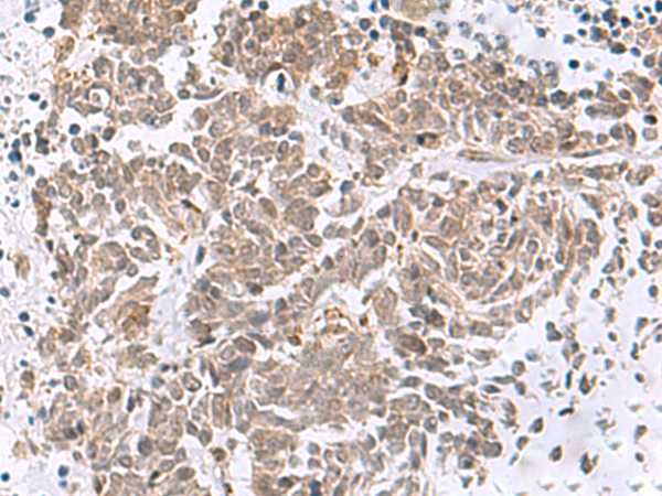 Rabbit Polyclonal Antibody to RBFOX2