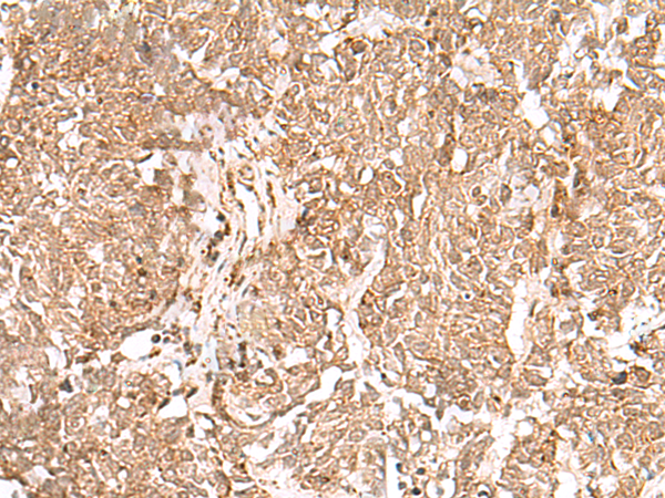 Rabbit Polyclonal Antibody to GMPPB
