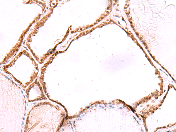 Rabbit Polyclonal Antibody to LMCD1