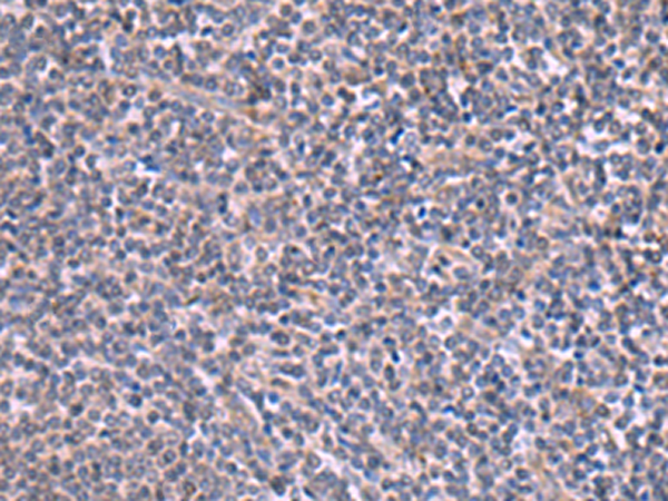 Rabbit Polyclonal Antibody to RIC3