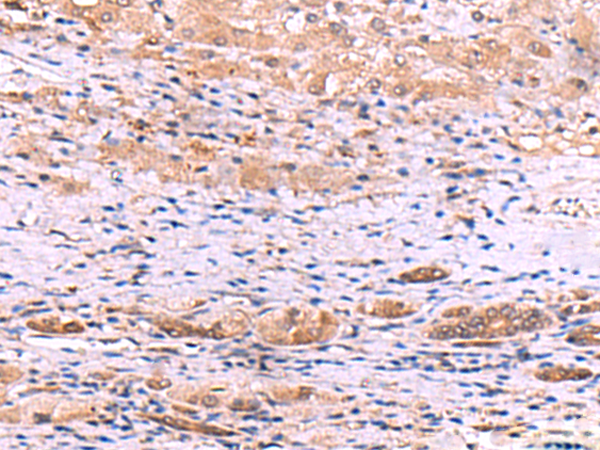 Rabbit Polyclonal Antibody to DHPS