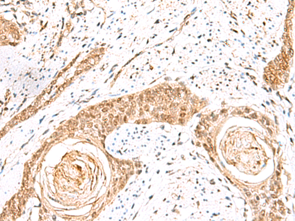 Rabbit Polyclonal Antibody to ELF3