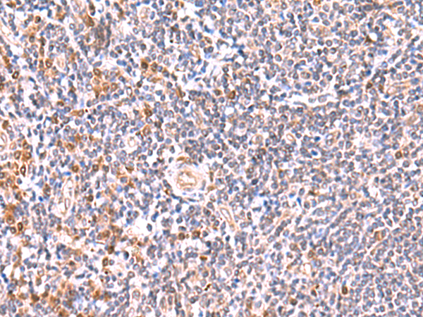 Rabbit Polyclonal Antibody to GMDS