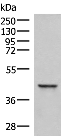 Rabbit Polyclonal Antibody to SAMSN1