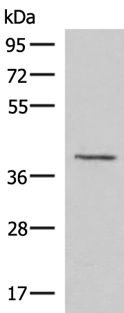Rabbit Polyclonal Antibody to MECR