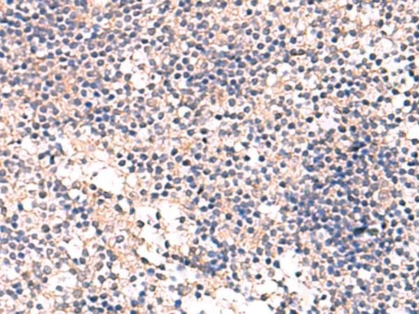 Rabbit Polyclonal Antibody to MKS1