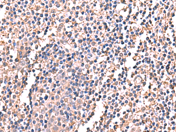 Rabbit Polyclonal Antibody to LDHAL6B