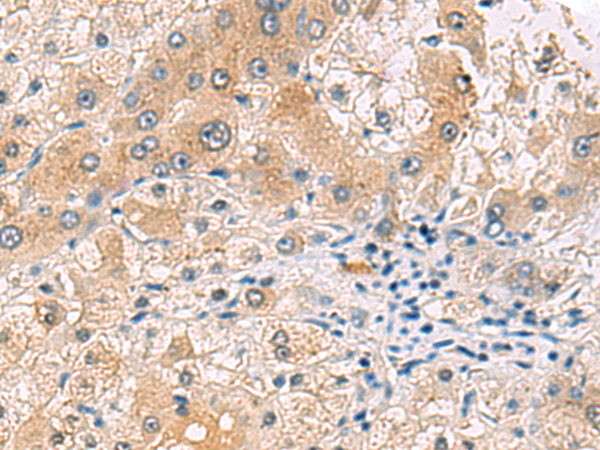 Rabbit Polyclonal Antibody to RNF13